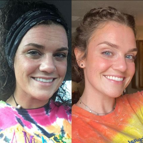 Aurelia™ Silicone Scar Sheets